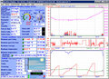 Thumbnail for version as of 19:46, 15 January 2006